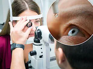 Dry Eye Disease: A Growing Public Health Concern in the UK's Over-50 Population