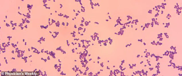 Medical Emergency: Harmless Skin Bacteria Now Causing Fatal Infections, Experts Warn