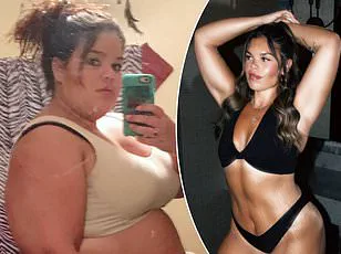 Melissa Schloemer's Journey: Gastric Sleeve Surgery and the Road to Weight Loss