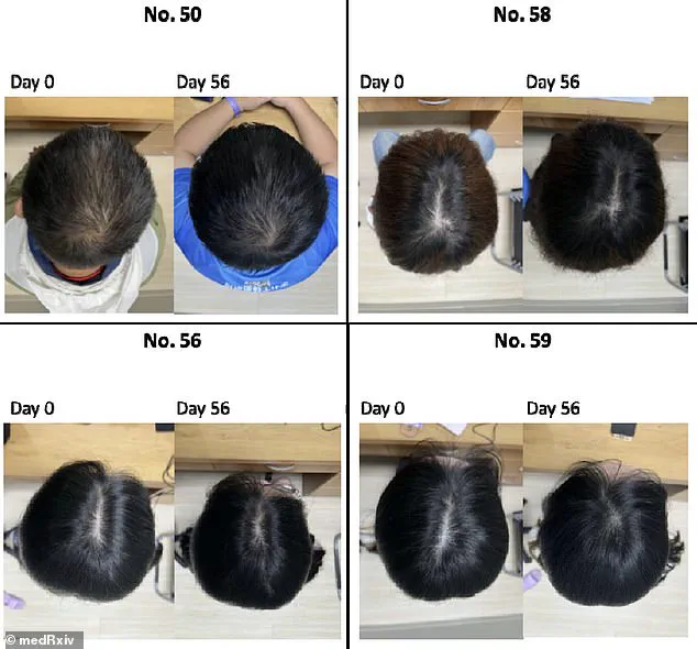 Taiwan Researchers Discover Hair Loss Treatment Using Centella Asiatica's Extracellular Vesicles