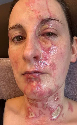 Kitchen Appliance Safety Standards Under Scrutiny After Harpist's Blender Injury