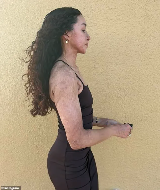 Exclusive: The Violent Attack That Stole a Young Bodybuilder's Dream – Limited Access to the Truth