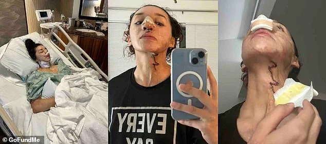 Exclusive: The Violent Attack That Stole a Young Bodybuilder's Dream – Limited Access to the Truth