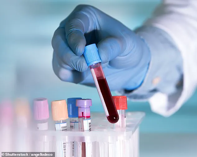 First NHS Patient Receives Groundbreaking CAR-T Therapy for B-Cell ALL in Historic Cancer Treatment Milestone