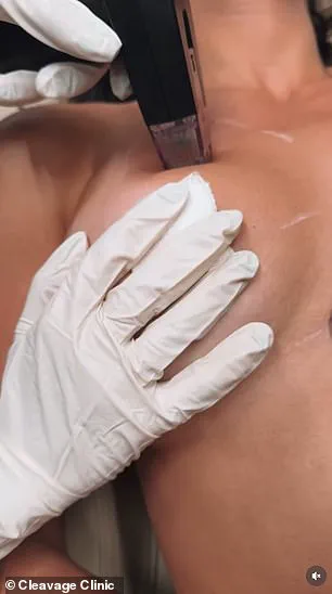 Non-Surgical Breast Enhancement Procedures at Cleavage Clinic in Midtown Manhattan Cost Up to $7,000