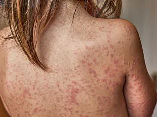 UK Health Agency Issues Warning on Nipah Virus Amid High Mortality Rates and Low Public Risk