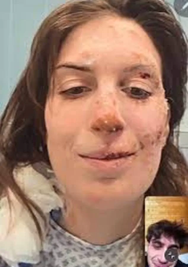Eleonora Palmieri's Recovery After Le Constellation Nightclub Fire in Switzerland