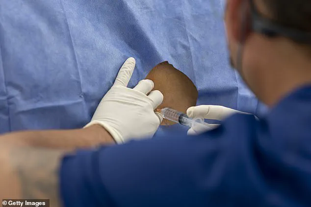 Experimental Antibiotic Gel Shows Promise in Alleviating Chronic Back Pain