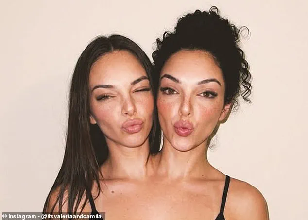 Conjoined Twin Influencers: Are They Real or AI-Generated?