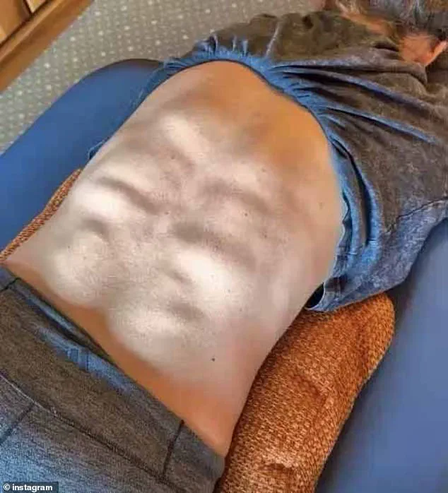 Mikaela Shiffrin's Stunning Back Muscles: Redefining the 'Six-Pack' in Olympic Fitness