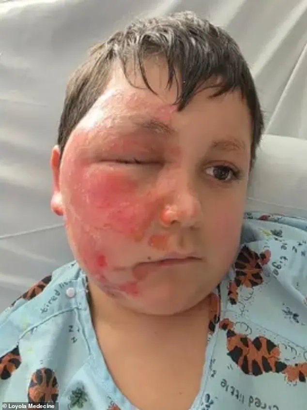 Nine-Year-Old Suffers Severe Burns After Microwaving Sensory Toy in Viral TikTok Challenge