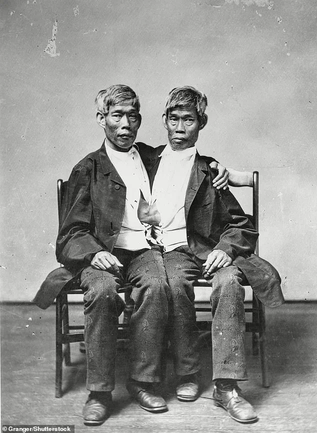 AI-Generated Conjoined Twins Go Viral, Raising Ethical Questions About Digital Commodification