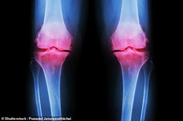 Britons Live Longer, But Healthy Years Are Shrinking, Study Finds