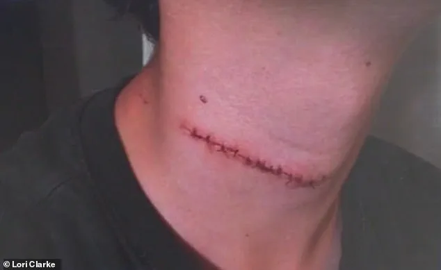 Teenager Survives Brutal Knife Attack at Daytona Beach