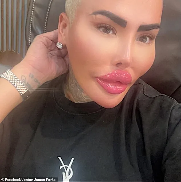 Tragic Death of 'The Lip King' Sparks Arrests and Industry Scrutiny