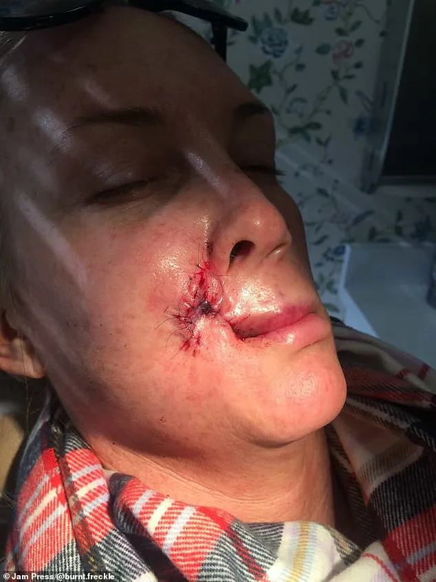 Kory Feltz's 20-Year Skin Cancer Battle: Fear and Resilience