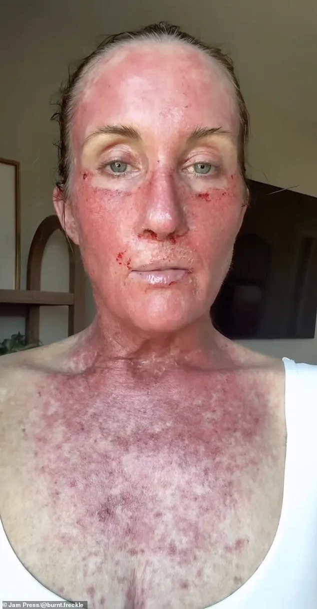 Kory Feltz's 20-Year Skin Cancer Battle: Fear and Resilience