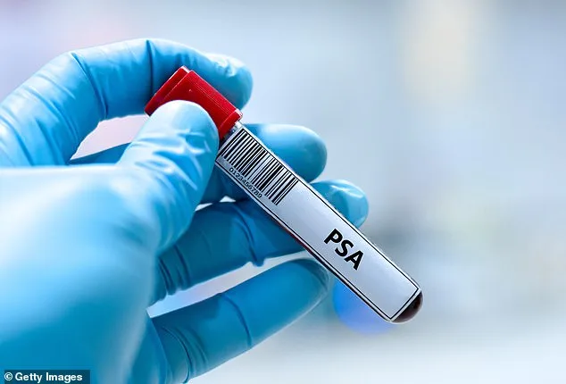 Breakthrough in Prostate Cancer Prevention: Metformin Slashes Risk by Over a Third for Just 2p Per Tablet