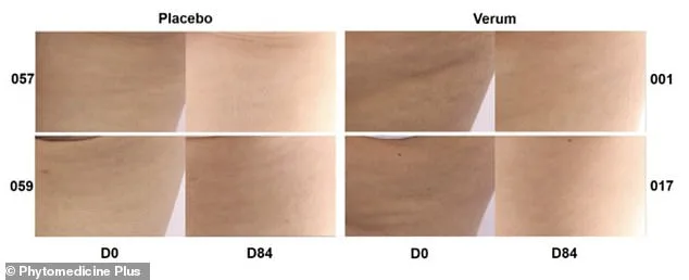 Tiny Pill, Big Impact: How a $1.25 Supplement is Revolutionizing the Fight Against Cellulite
