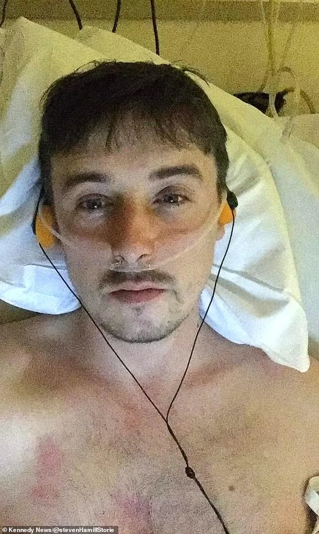 A Warning from Steven Hamill: How Delayed Diagnosis of Penile Cancer Nearly Cost His Life