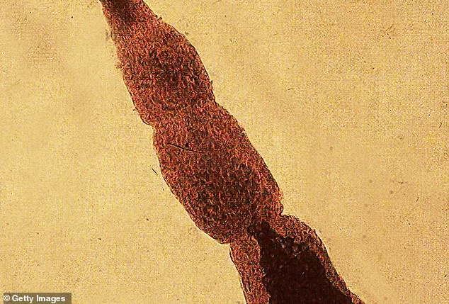 Deadly Fox Tapeworm Spreading in U.S., Alveolar Echinococcosis Emerges as New Health Threat